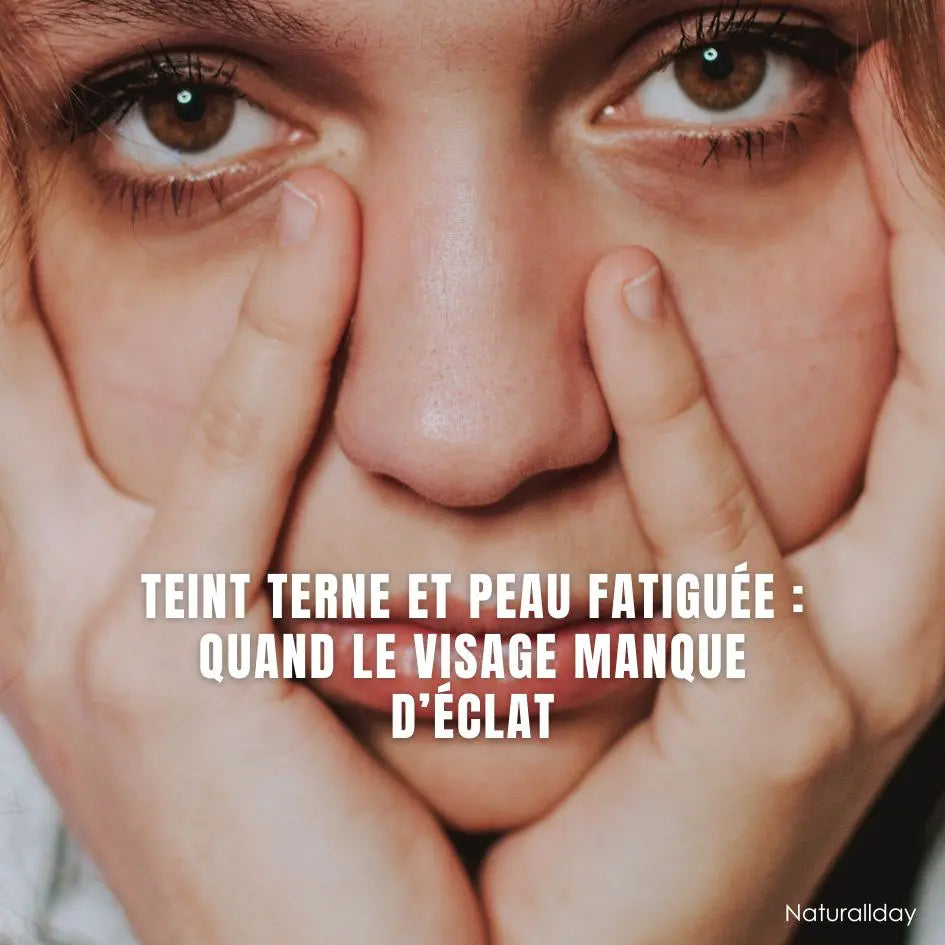 Teint terne : causes, erreurs et solutions naturelles pour retrouver de l’éclat